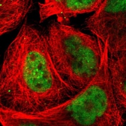 FAM122B Antibody, Novus Biologicals 25 &mu;L; Unlabeled:Antibodies, Polyclonal
