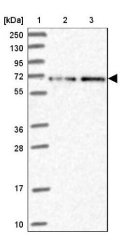 FAM123A Antibody, Novus Biologicals 25 &mu;L, Unlabeled:Antibodies, Polyclonal