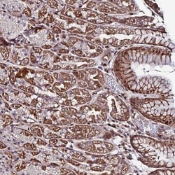 FAM123C Antibody, Novus Biologicals:Antibodies:Primary Antibodies