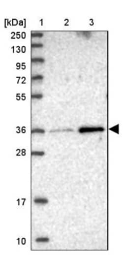 FAM125B Antibody, Novus Biologicals 25ul | Buy Online | Novus Biologicals | Fisher Scientific