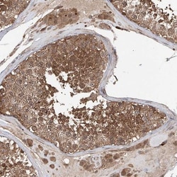 FAM135A Antibody, Novus Biologicals 0.1mL; Unlabeled:Antibodies, Polyclonal