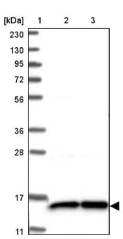 FAM136A Antibody, Novus Biologicals 0.1mL; Unlabeled:Antibodies, Polyclonal