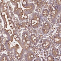 FAM13A Antibody, Novus Biologicals 0.1 mL | Buy Online | Novus Biologicals | Fisher Scientific