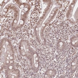FAM13A Antibody, Novus Biologicals:Antibodies:Primary Antibodies