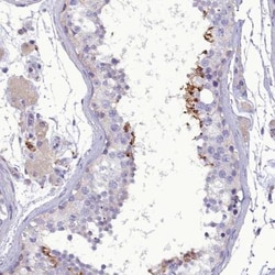 FAM149B1 Antibody, Novus Biologicals 25 &mu;L; Unlabeled:Antibodies, Polyclonal