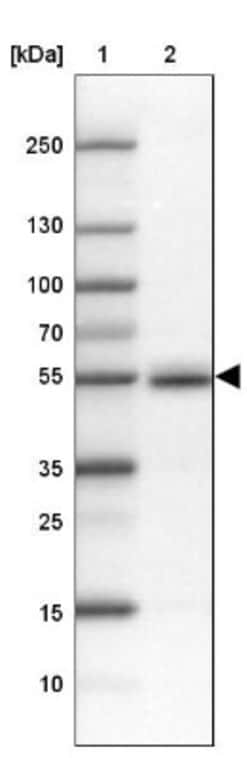 FAM149B1 Antibody, Novus Biologicals 25 &mu;L; Unlabeled:Antibodies, Polyclonal