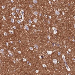 FAM155A Antibody, Novus Biologicals:Antibodies:Primary Antibodies