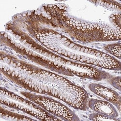 FAM160A1 Antibody, Novus Biologicals:Antibodies:Primary Antibodies
