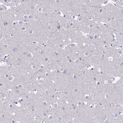 FAM160A1 Antibody, Novus Biologicals:Antibodies:Primary Antibodies