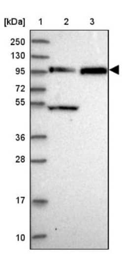 FAM160B1 Antibody, Novus Biologicals 25 &mu;L | Buy Online | Novus Biologicals | Fisher Scientific