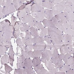 FAM161A Antibody, Novus Biologicals 25 &mu;L, Unlabeled:Antibodies, Polyclonal