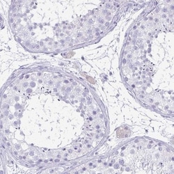 FAM162B Antibody, Novus Biologicals:Antibodies:Primary Antibodies
