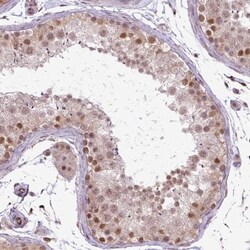 FAM164C Antibody, Novus Biologicals:Antibodies:Primary Antibodies