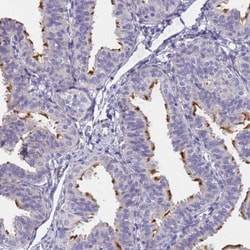 FAM166B Antibody, Novus Biologicals:Antibodies:Primary Antibodies