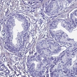 FAM166B Antibody, Novus Biologicals:Antibodies:Primary Antibodies