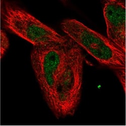 FAM168A Antibody, Novus Biologicals 25 &mu;L; Unlabeled:Antibodies, Polyclonal