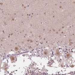 FAM168A Antibody, Novus Biologicals 25 &mu;L; Unlabeled:Antibodies, Polyclonal