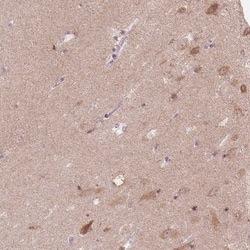FAM168A Antibody, Novus Biologicals 25 &mu;L; Unlabeled:Antibodies, Polyclonal