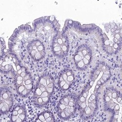 FAM169A Antibody, Novus Biologicals 25 &mu;L, Unlabeled:Antibodies, Polyclonal
