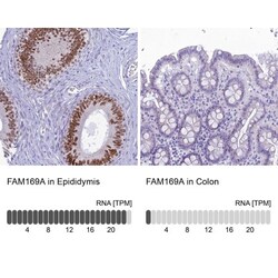 FAM169A Antibody, Novus Biologicals 25 &mu;L, Unlabeled:Antibodies, Polyclonal