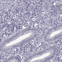 FAM170A Antibody, Novus Biologicals 0.1mL; Unlabeled:Antibodies, Polyclonal