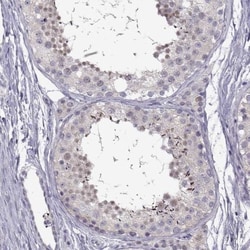 FAM170A Antibody, Novus Biologicals 0.1mL; Unlabeled:Antibodies, Polyclonal