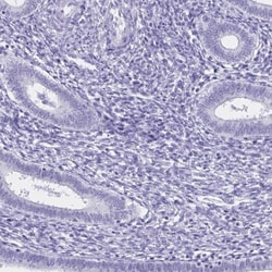 FAM170A Antibody, Novus Biologicals:Antibodies:Primary Antibodies