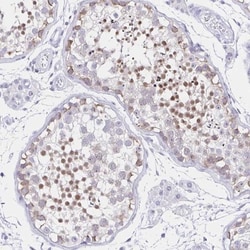 FAM170A Antibody, Novus Biologicals:Antibodies:Primary Antibodies