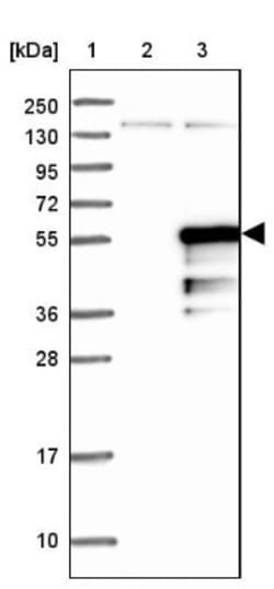 FAM170A Antibody, Novus Biologicals 0.1mL; Unlabeled:Antibodies, Polyclonal