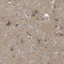 FAM171B Antibody, Novus Biologicals 25 &mu;L, Unlabeled:Antibodies, Polyclonal