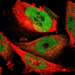 INPP1 Antibody, Novus Biologicals:Antibodies:Primary Antibodies