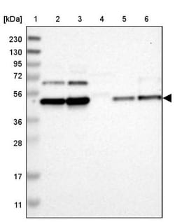 INPP1 Antibody, Novus Biologicals:Antibodies:Primary Antibodies