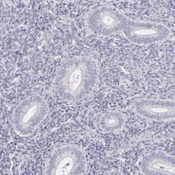 FAM181A Antibody, Novus Biologicals:Antibodies:Primary Antibodies