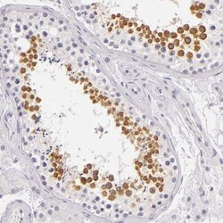 FAM181A Antibody, Novus Biologicals 25 &mu;L, Unconjugated:Antibodies,