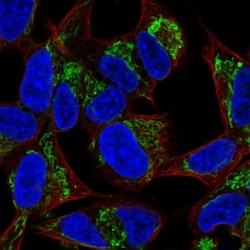 FAM181B Antibody, Novus Biologicals:Antibodies:Primary Antibodies