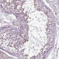 FAM183A Antibody, Novus Biologicals 0.1mL; Unlabeled:Antibodies, Polyclonal