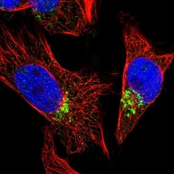FAM18B Antibody, Novus Biologicals:Antibodies:Primary Antibodies