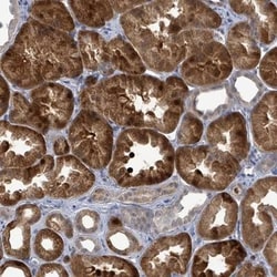 FAM194A Antibody, Novus Biologicals 25 &mu;L, Unlabeled:Antibodies, Polyclonal