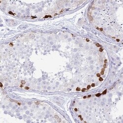 FAM194A Antibody, Novus Biologicals 25 &mu;L, Unlabeled:Antibodies, Polyclonal