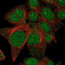ACOX3 Antibody, Novus Biologicals:Antibodies:Primary Antibodies