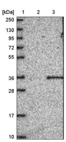 FAM207A Antibody, Novus Biologicals 0.1mL; Unlabeled:Antibodies, Polyclonal