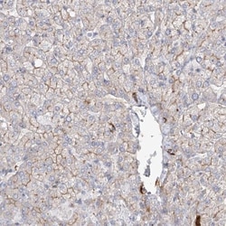 FAM208B Antibody, Novus Biologicals:Antibodies:Primary Antibodies