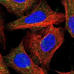 FAM21A Antibody, Novus Biologicals 100uL; Unlabeled:Antibodies, Polyclonal