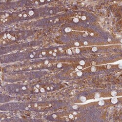FAM21A Antibody, Novus Biologicals 100uL; Unlabeled:Antibodies, Polyclonal