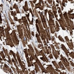 FAM26E Antibody, Novus Biologicals 0.1mL; Unlabeled:Antibodies, Polyclonal