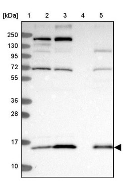 FAM36A Antibody, Novus Biologicals 0.1mL; Unlabeled:Antibodies, Polyclonal