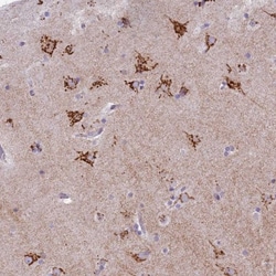 FAM3C Antibody, Novus Biologicals 0.1mL; Unlabeled:Antibodies, Polyclonal