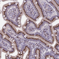 FAM3C Antibody, Novus Biologicals 0.1mL; Unlabeled:Antibodies, Polyclonal
