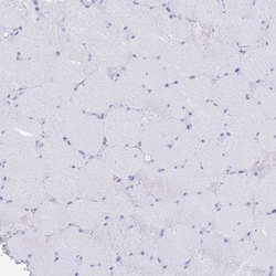 FAM3C Antibody, Novus Biologicals:Antibodies:Primary Antibodies