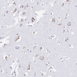 FAM3C Antibody, Novus Biologicals:Antibodies:Primary Antibodies